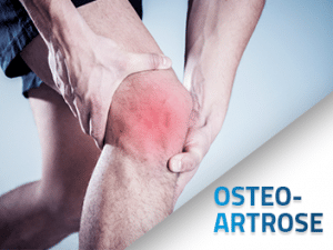 Osteoartrose – Saiba O Que É e Como Funciona o Tratamento | Ethos